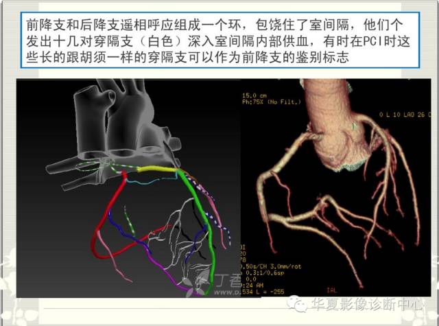 图文详解冠脉解剖及分段，值得收藏！