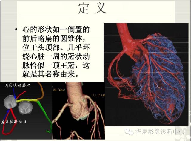 图文详解冠脉解剖及分段，值得收藏！