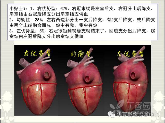 图文详解冠脉解剖及分段，值得收藏！