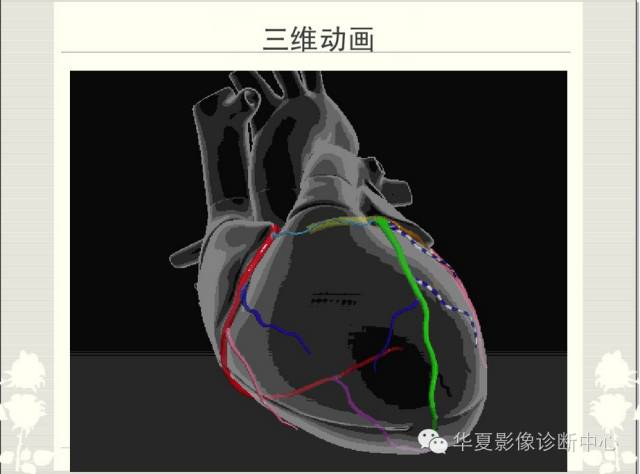 图文详解冠脉解剖及分段，值得收藏！