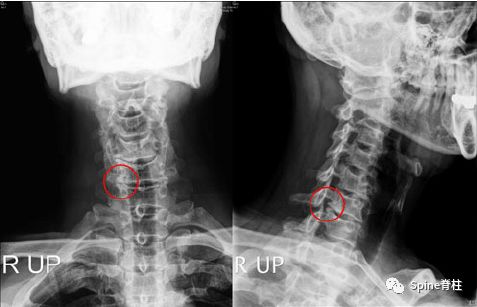 干货！颈椎