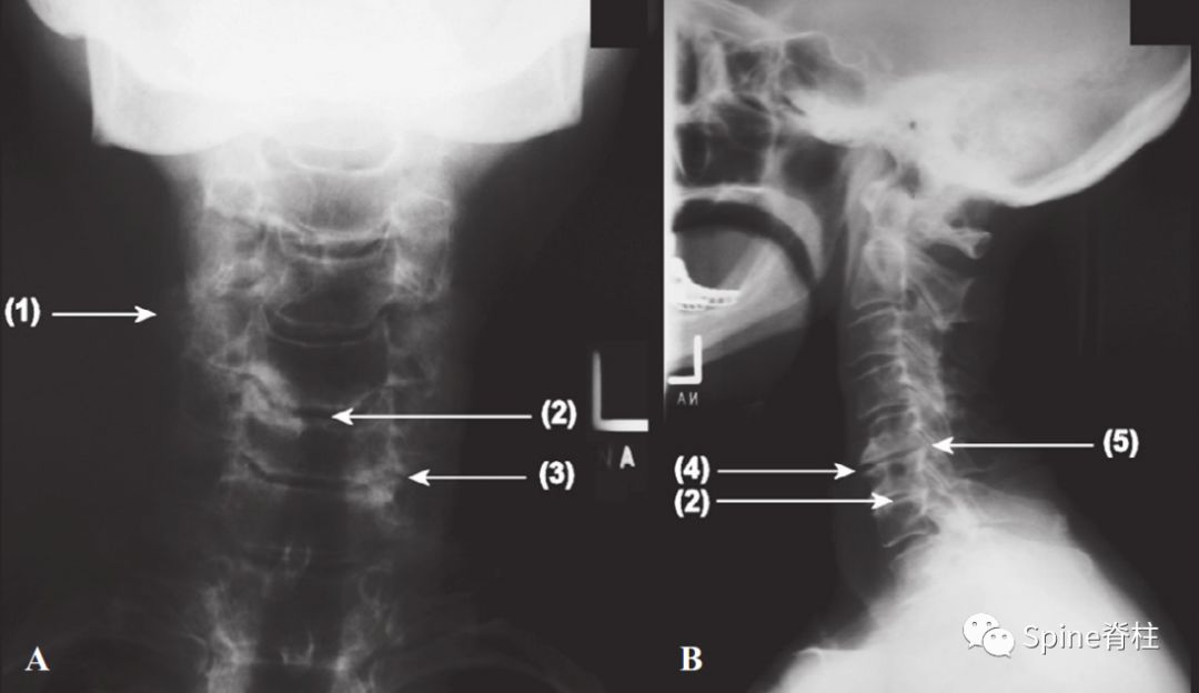 干货！颈椎