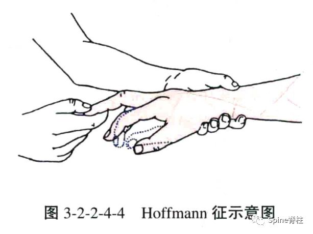 关于Hoffmann