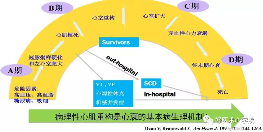 心梗治好了，为什么还要“抗心肌重构”？