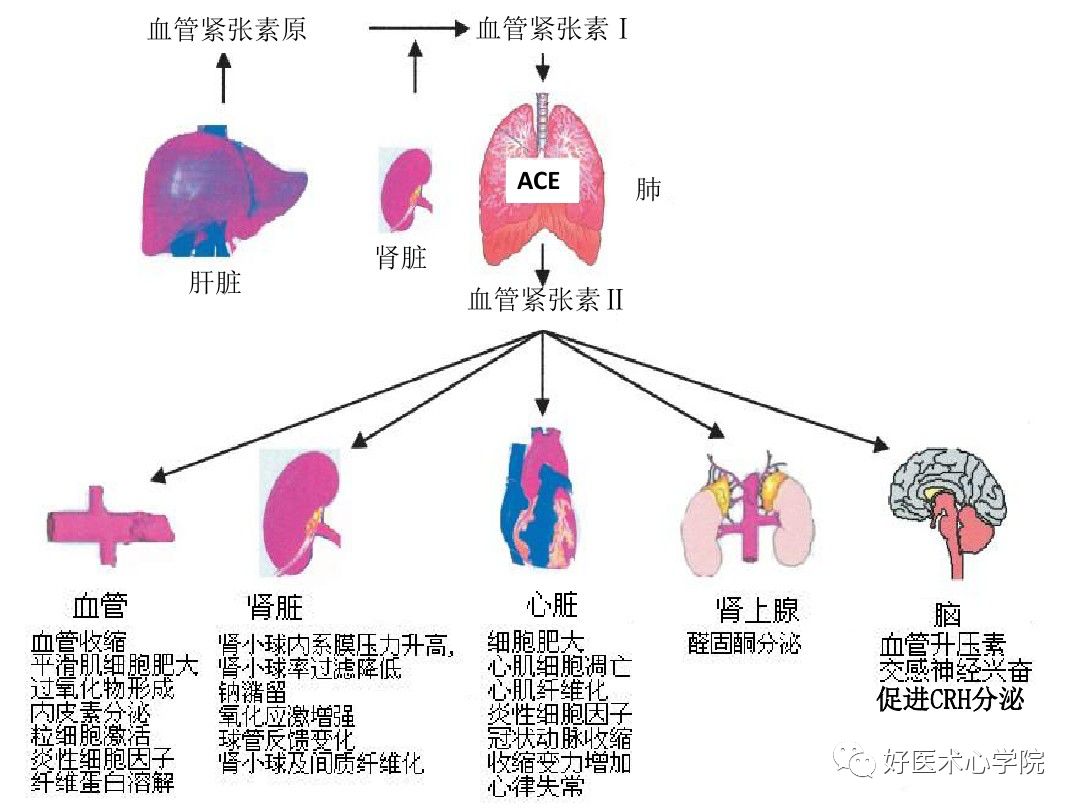 心梗治好了，为什么还要“抗心肌重构”？