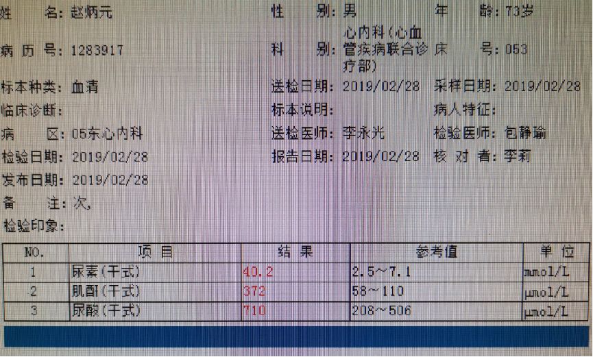 严重钙化伴夹层，旋磨的过程惊心动魄