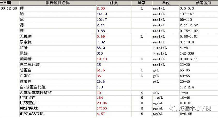 细数急性心梗合并顽固性心衰的N种处理对策