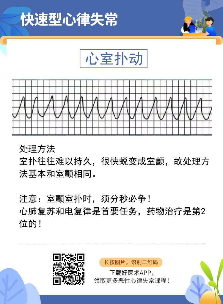 6张图掌握常见恶性心律失常处理策略