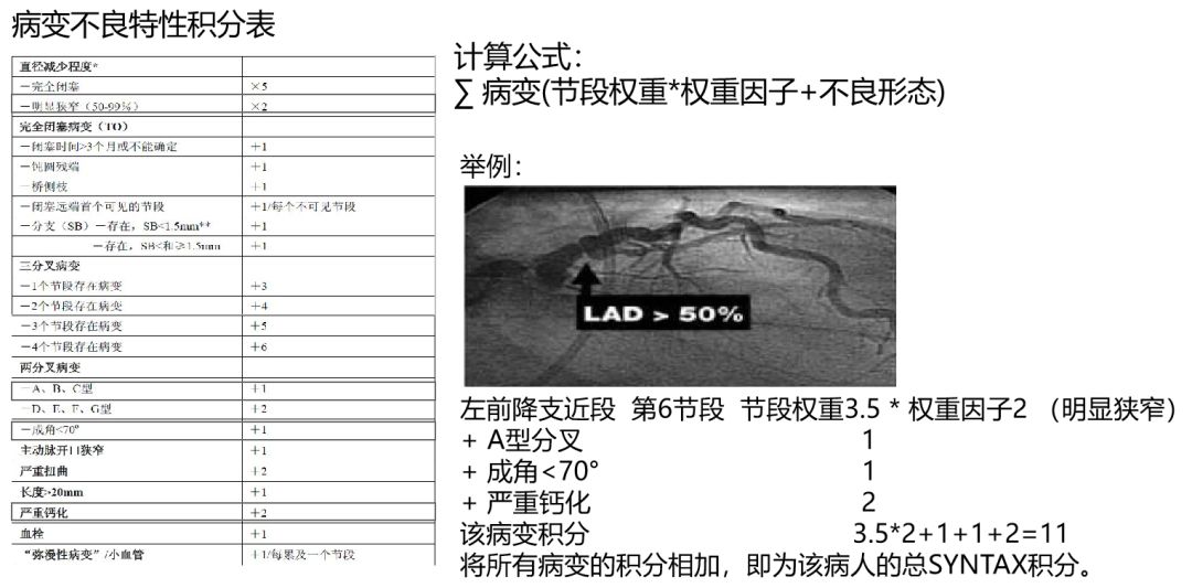 介入医师必看—冠脉造影的判断与评估