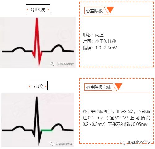 窦性心律，到底是个什么“病”？