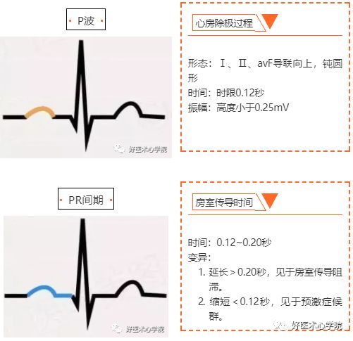 窦性心律，到底是个什么“病”？