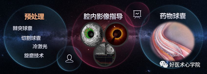 冠心病介入治疗的新技术,来挑战吧！