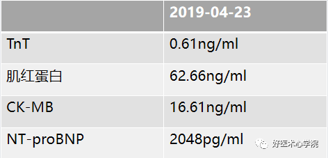 ST段抬高的胸痛，冠脉造影却正常，应该考虑什么疾病？