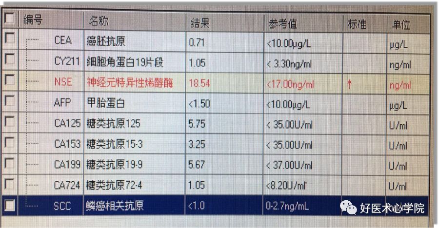 ST段抬高的胸痛，冠脉造影却正常，应该考虑什么疾病？