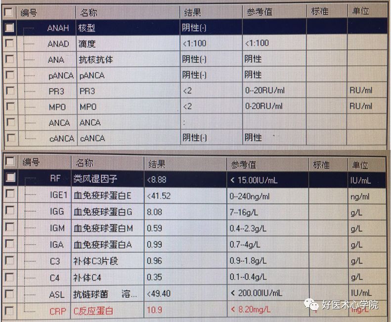 ST段抬高的胸痛，冠脉造影却正常，应该考虑什么疾病？