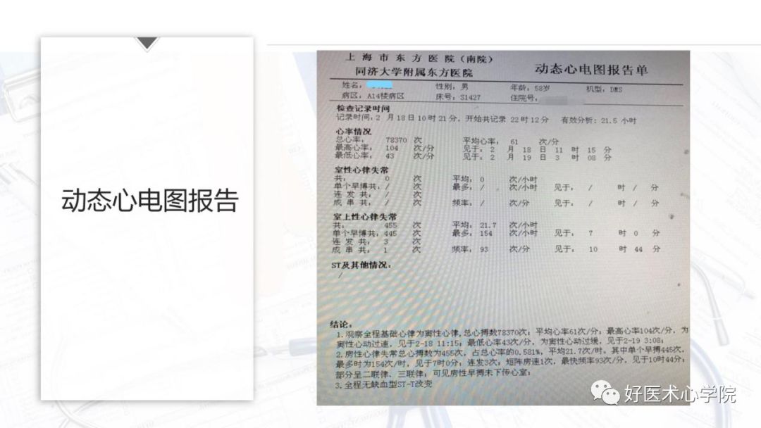 不被重视的心悸，险些酿成大祸