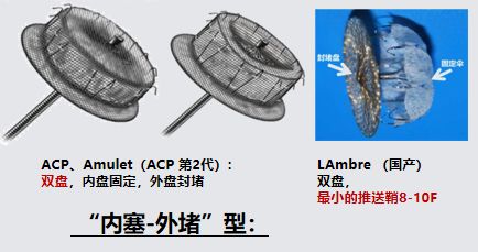 干货！左心耳封堵术实操技巧