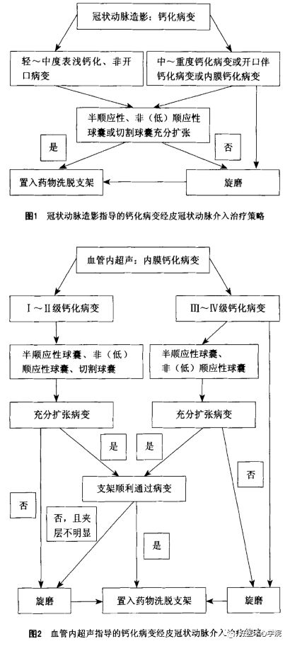 冠脉钙化病变介入治疗的常见问题与处理（附流程图）