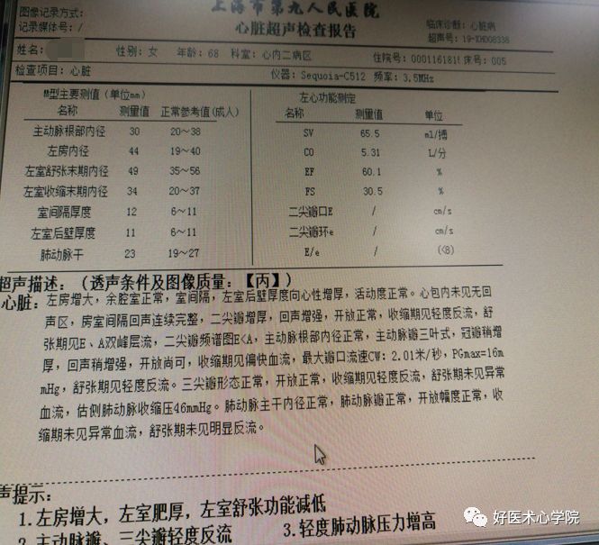 四个病例带你深度剖析室早的导管消融治疗