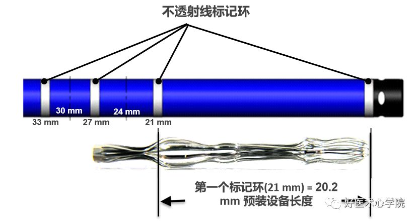 左心耳封堵术流程攻略