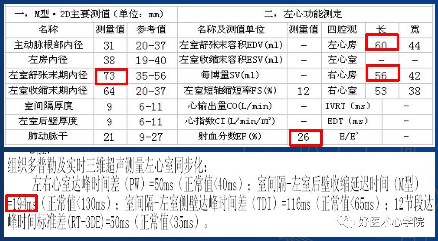 实用攻略贴！左室电极靶静脉植入操作技巧！