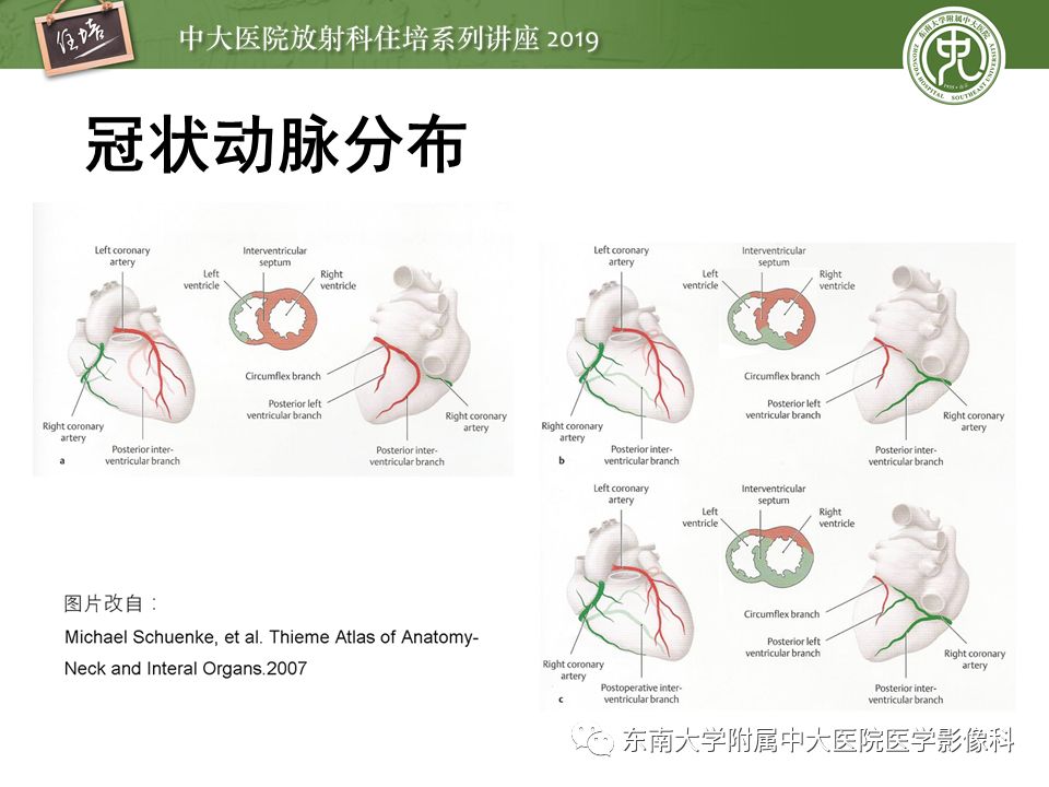 不能错过！冠状动脉CTA诊断超全教程