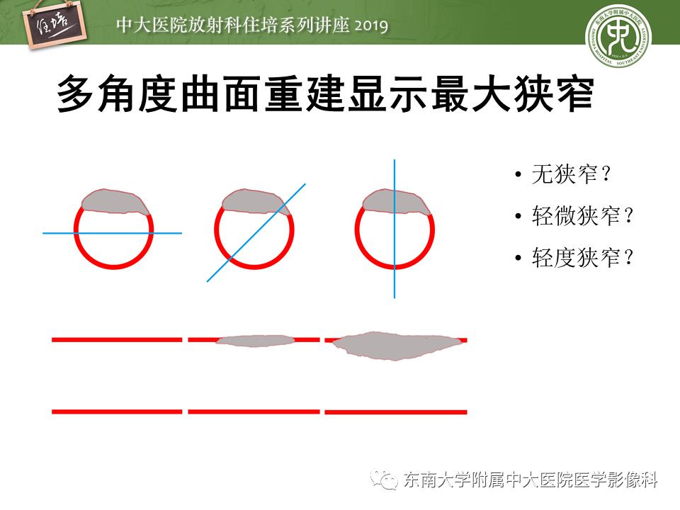 不能错过！冠状动脉CTA诊断超全教程