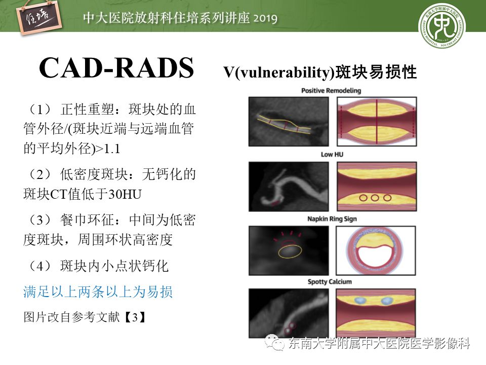 不能错过！冠状动脉CTA诊断超全教程