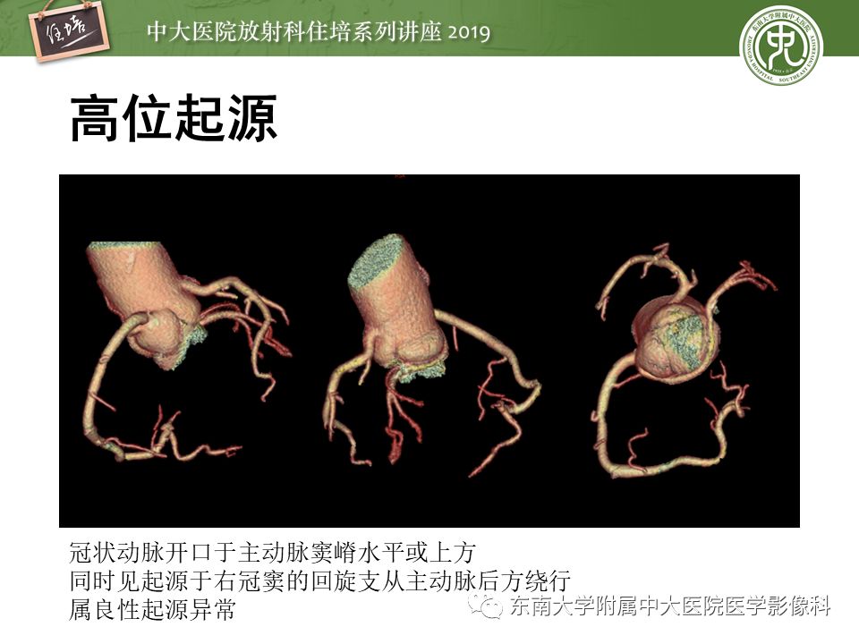 不能错过！冠状动脉CTA诊断超全教程