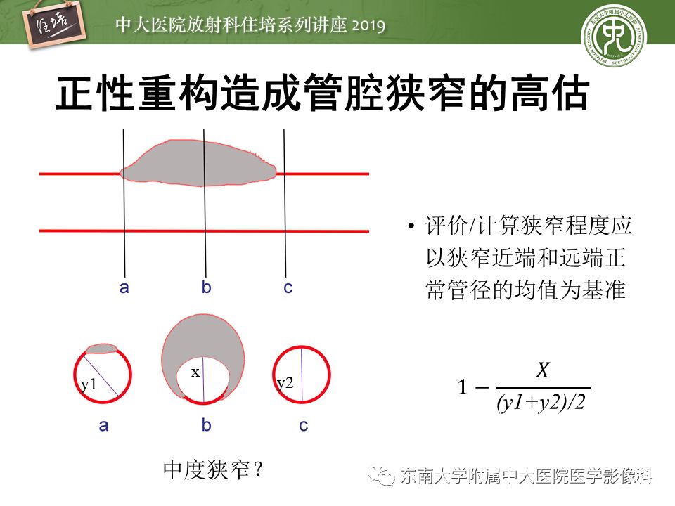 不能错过！冠状动脉CTA诊断超全教程