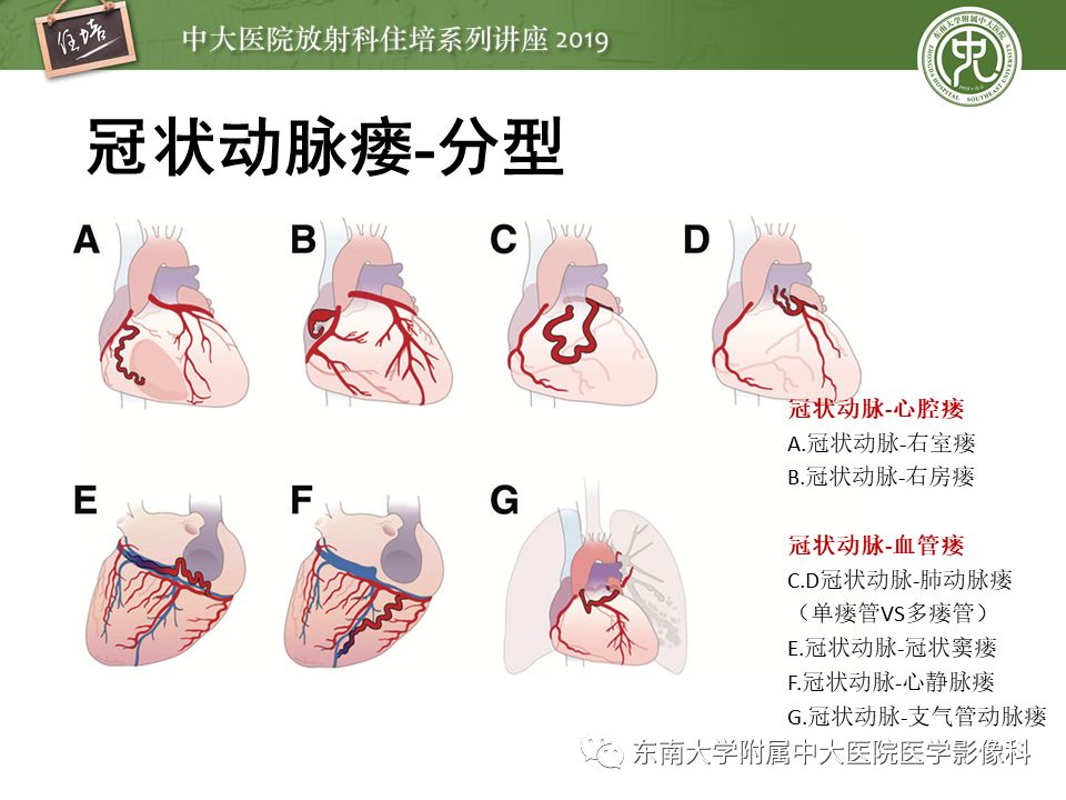 不能错过！冠状动脉CTA诊断超全教程