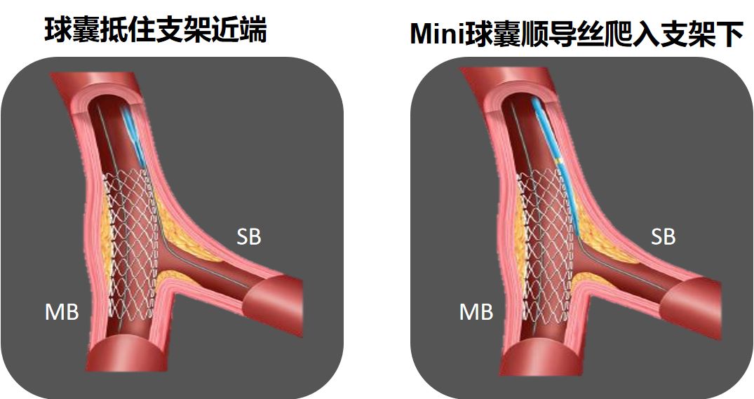 一文掌握：PCI