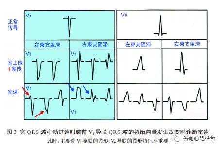 关于室速积分法，本文非常全面了！