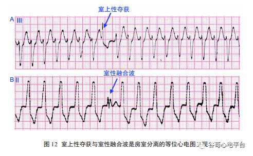 关于室速积分法，本文非常全面了！