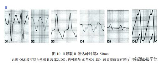 关于室速积分法，本文非常全面了！