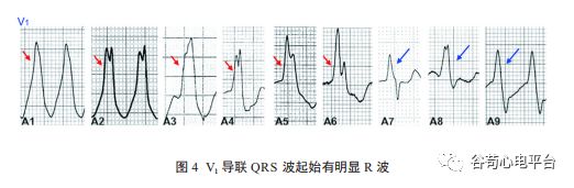 关于室速积分法，本文非常全面了！