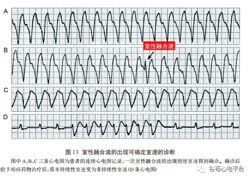 关于室速积分法，本文非常全面了！