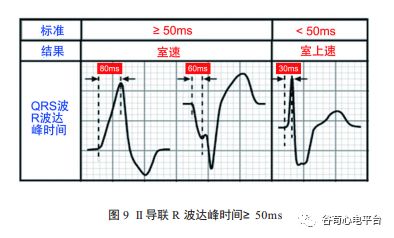 关于室速积分法，本文非常全面了！