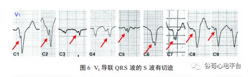 关于室速积分法，本文非常全面了！