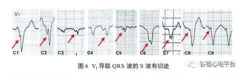 关于室速积分法，本文非常全面了！