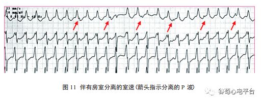 关于室速积分法，本文非常全面了！