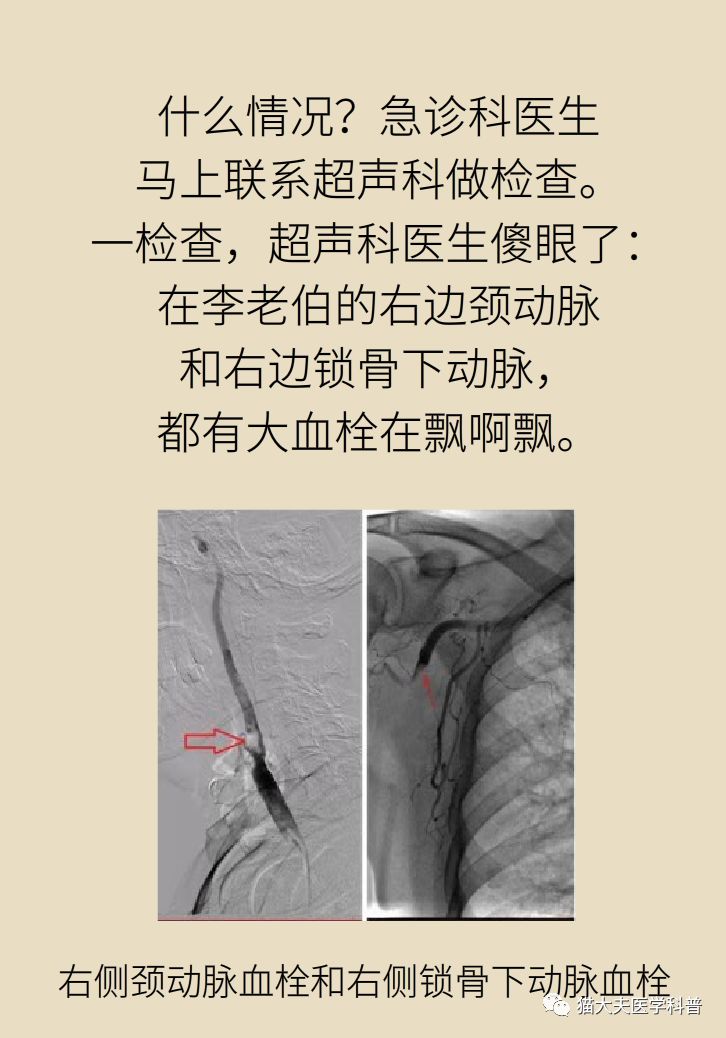 你以为「喉咙痛」很简单？