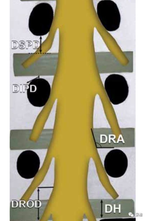 腰椎间盘摘除术技巧详解，值得一看！