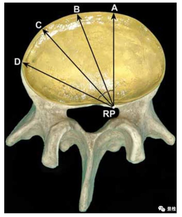 腰椎间盘摘除术技巧详解，值得一看！
