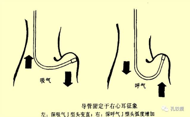 手把手教你做心脏起搏器(精美图文教学)