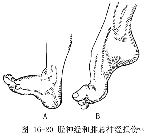 文章详情