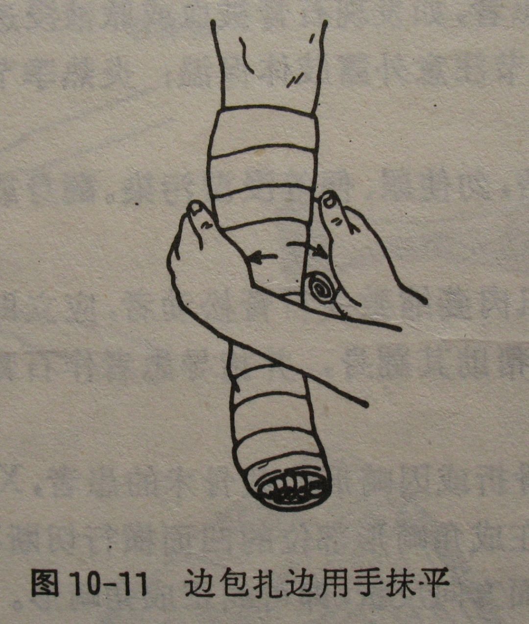 全身各部位石膏固定注意事项及操作技巧汇总，收藏备用！