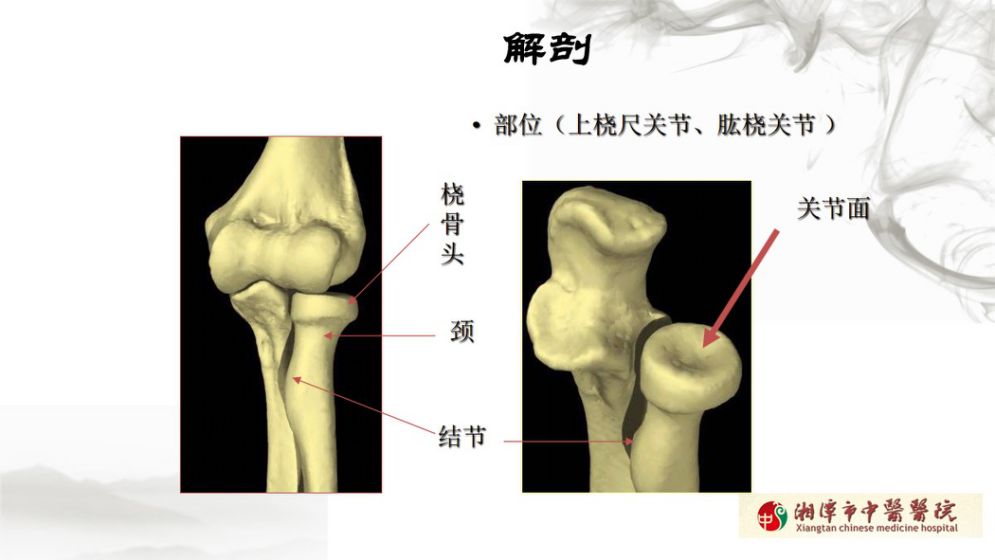 骨科医生必须掌握：桡骨颈骨折的7种治疗方法！