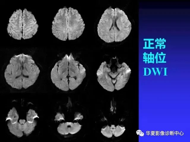入门必修课：头颅MRI读片详解 - 好医术早读文章 - 好医术-赋能医生守护生命